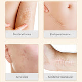 Scar Removal