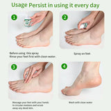 Foot Peeling And Exfoliating Spray